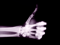 radiologie de la main